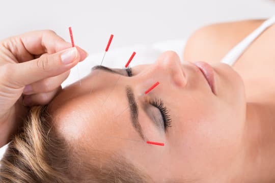TCM & Akupunktur in der Naturheilpraxis Karra — Traditionelle Chinesische Medizin & Akupunktur